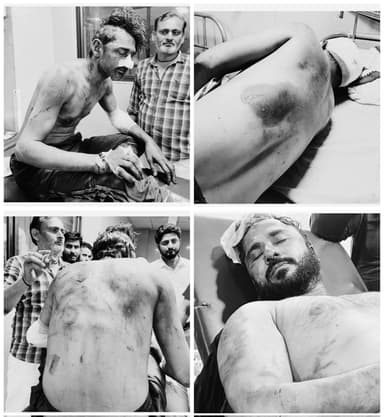 ಅಲಿಘರ್: ಗೋ ರಕ್ಷಕರಿಂದ ಮುಸ್ಲಿಂ ಯುವಕರ ಮೇಲೆ ಹಲ್ಲೆ, ವಾಹನಕ್ಕೆ ಬೆಂಕಿ; ವಸೂಲಿ ಆರೋಪ